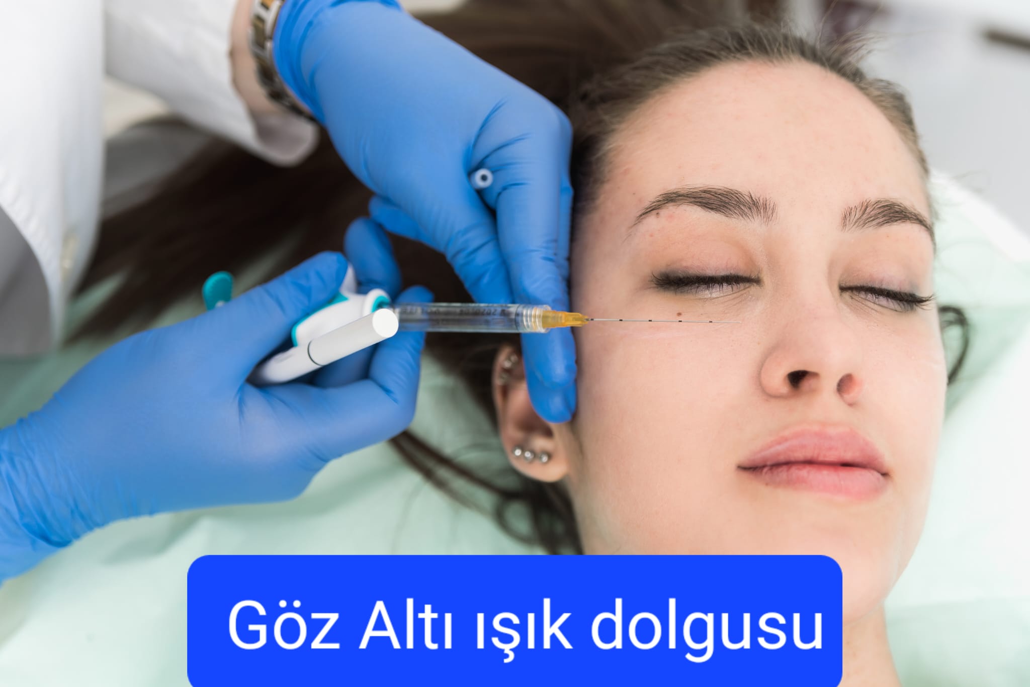 Göz Altı Işık Dolgusu